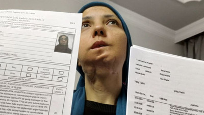 11 yılda 35 ameliyat geçirdi; son ameliyatı olmazsa dili alınacak
