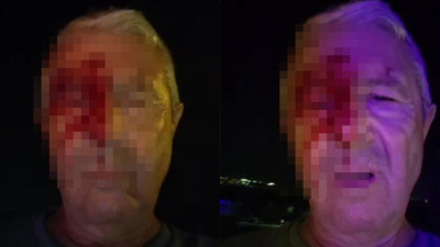 Haber yaparken saldırıya uğrayan muhabir yaralandı