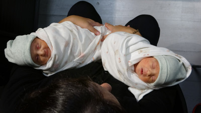 Dünyada 3. kez Trabzon'da yaşandı: Bir beden, iki rahim, ikiz bebek