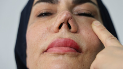 4 yılda 4 ameliyat geçirdi: Hayatı kabusa döndü