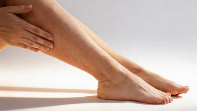 Çilek bacak görünümünü azaltmak isterken dikkat! Peeling ters etki yapabilir
