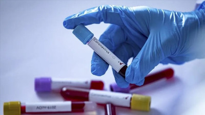 Sibirya’da gizemli hastalık alarmı: Temaslıların test sonuçları ortaya çıktı