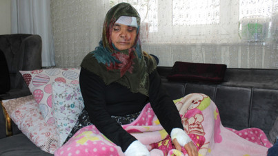 Kızının köpeği Fadimana'yı bu hale getirdi