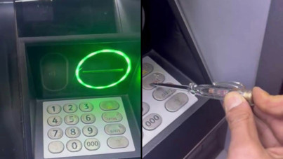 ATM'den para çekerken çarpıldı: Parmağımı hissetmiyorum