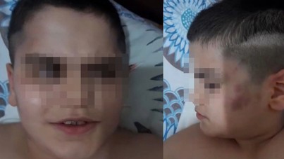 Otizmli öğrenciye öğretmenden dayak iddiası