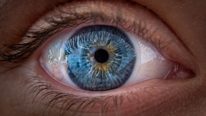 Bilim insanlarından çığır açacak buluş: Görme kaybının çaresi 'altın' olabilir