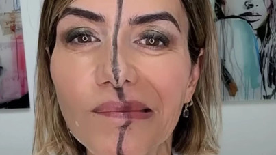 Yüzünün sadece bir tarafına botoks uyguladı, aradaki beklenmedik farkı gösterdi