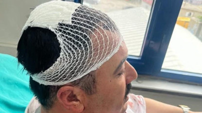 Belediye başkan yardımcısını yaralayan il başkan yardımcısı tutuklandı