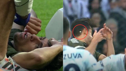 Beşiktaşlı yıldızın dişi kırıldı, Solskjaer'in tepkisi güldürdü