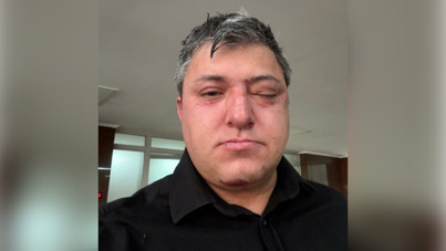 Belediye personelinden 'belediye başkanı ve yardımcıları beni darbetti' iddiası