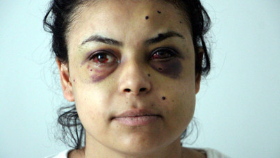 Düğün magandaları Nazar'ı gözünden vurdu