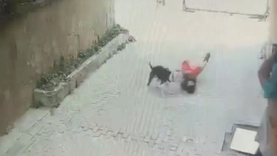 Pitbull 7 yaşındaki çocuğa saldırdı