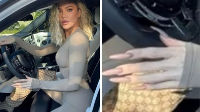 Popüler zayıflama ilaçlarının görünmeyen yüzü: 'Ozempic eller'