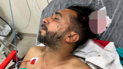 Döner ustası yorgun mermiyle başından vuruldu