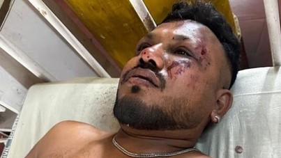 11A mucizesi: Düşen uçaktan bir tek o kurtuldu