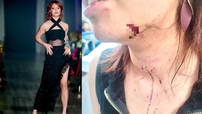 Genç manken metroda saldırıya uğradı