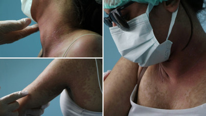 İnternetten aldığı krem yüzünden hastanelik oldu: İçeriği şok etti