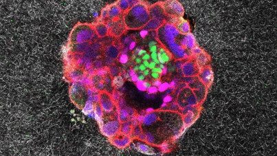 İnsan embriyosunun anne rahmine tutunuşu ilk kez görüntülendi