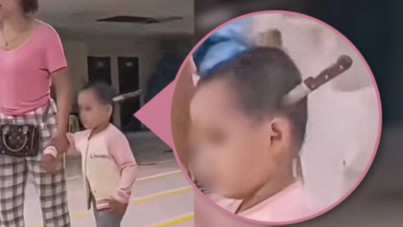 Küçük kız kafasında bıçakla hastaneye gitti