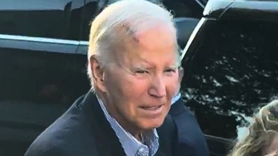 Eski başkanın kafasındaki yara korkuttu