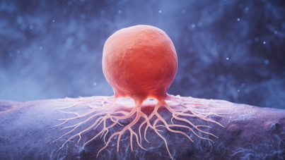 Ailenizde kanser öyküsü varsa dikkat: Doktorlardan 6 altın öneri