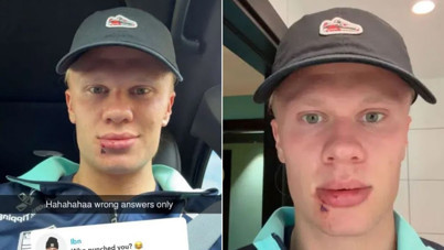 Erling Haaland'ın sakarlığı tuttu: Üç dikiş atıldı!