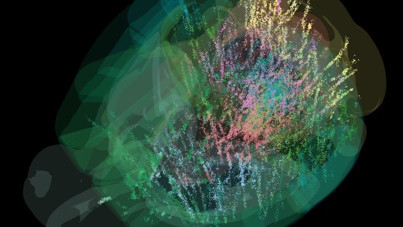 Tarihte bir ilk: Beynin 'karar anı'nın haritasını çıkardılar