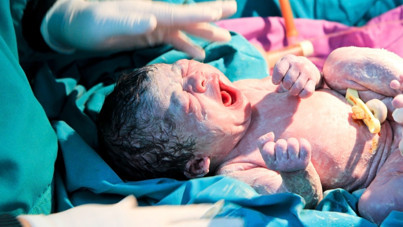 10 saatte 21 sezaryen ameliyatı yapan doktora soruşturma