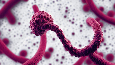 Ebola salgını: 35 kişi öldü