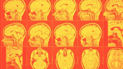 Katliam yapıp 'Beynimi inceleyin' demişti: Dikkat çeken bulgu