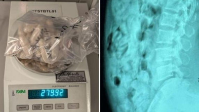 Midesinden 120 kapsül eroin çıktı