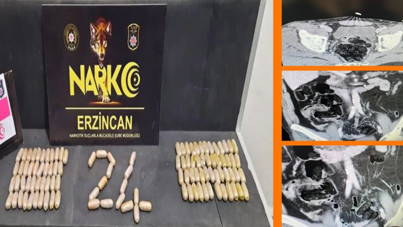 Midelerinden 780 gram uyuşturucu çıktı