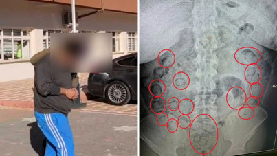 Midesinden 433 gram metamfetamin çıktı