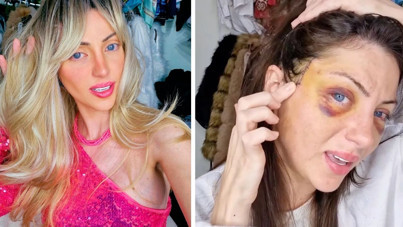 Barbie'ye benzemek için 27 kez ameliyat olmuştu: 31 yaşında öldü