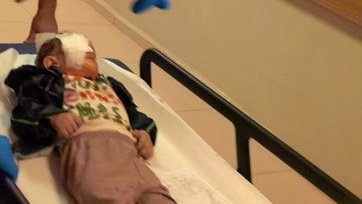 Torpil patladı, bir gözü kör oldu