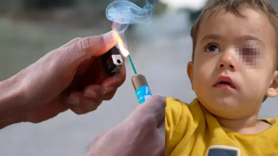 2 yaşındaki Alpaslan’ın gözünü kaybettiren torpil fırından satılmış