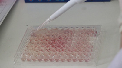 Mutluluk hormonunun kanserle sürpriz ilişkisi keşfedildi