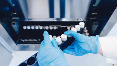 Sperm bankalarında yeni dönem: IQ testi yapılacak