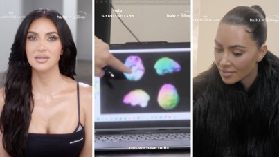 Kim Kardashian beyin taramasından geçti: Sonuca inanamadı