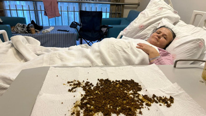 Safra kesesinden binlerce taş çıkarıldı