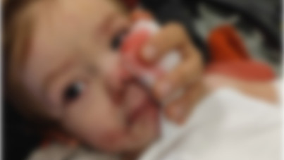 İki çocuk köpek saldırısında yaralandı