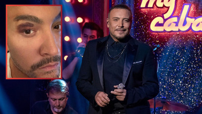 Cenk Eren sahnede talihsiz an yaşadı: Son halini paylaştı