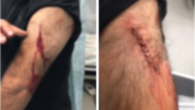 Öğretmene sokak ortasında jiletli saldırı