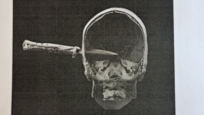 Almanya'yı sarsan cinayet: Nişanlısını dövdü, kuzeninin kafasına bıçak sapladı