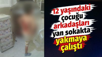 12 yaşındaki çocuğu arkadaşları yan sokakta yakmaya çalıştı