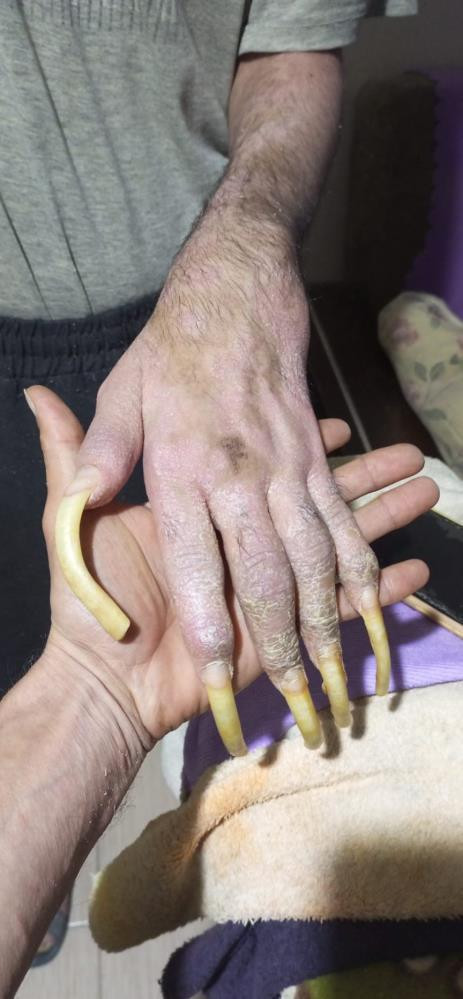 Kendini eve kapattı, 3 yıldır duş bile almıyor: Bıktım - Resim : 2