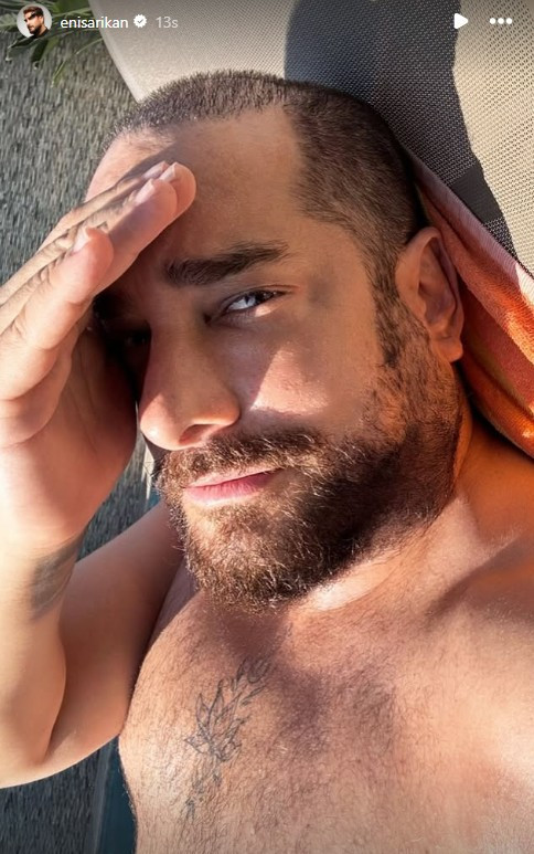 Enis Arıkan protez saçını çıkardı! Doğal halini paylaştı - Resim : 2