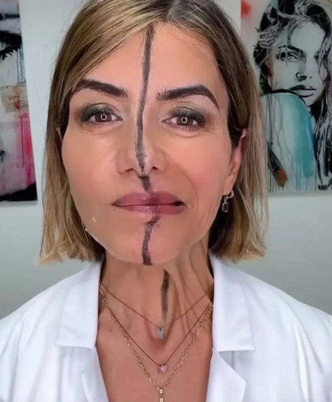 Yüzünün sadece bir tarafına botoks uyguladı, aradaki beklenmedik farkı gösterdi - Resim : 2