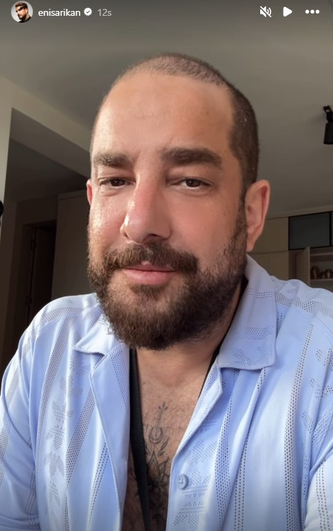 Enis Arıkan protez saçını çıkardı! Doğal halini paylaştı - Resim : 1