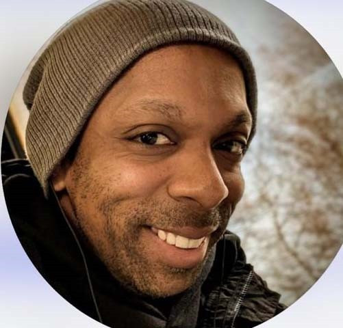 İstanbul'da saç ekimi yaptıran İngiliz öldü - Resim : 1